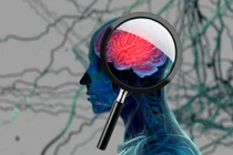 Ngủ sâu giấc giúp não thải các chất độc ra ngoài