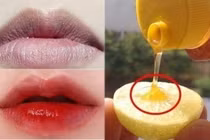 Thần dược trị thâm môi 1 phát ăn ngay có giá chỉ vài nghìn đồng