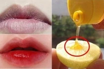 Thần dược trị thâm môi 1 phát ăn ngay có giá chỉ vài nghìn đồng