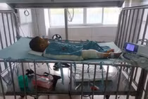Ngã vào nồi bỗng rượu đang sôi, bé 3 tuổi nguy kịch