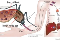Cách nhận biết và phòng tránh muỗi vằn