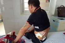 Nổ súng loạn xạ ở quán karaoke, nhiều người dính đạn