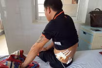 Nổ súng loạn xạ ở quán karaoke, nhiều người dính đạn