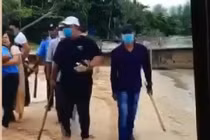 Cận cảnh 6 bảo vệ Resort Nam Nghi đánh gãy tay người dân Phú Quốc