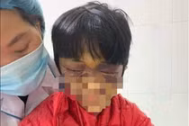 Bé gái 6 tuổi bị mẹ đẻ đang mang thai bạo hành dã man