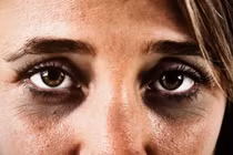 4 thứ này thâm đen... dễ mắc bệnh nguy hiểm, có 1 cũng nên đi khám