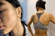 Siêu mẫu Khả Trang tung ảnh tố bị đánh đập bầm dập: Xử sao kẻ bạo hành?