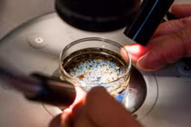 Phát hiện vi nhựa trong dịch nang buồng trứng gây chấn động