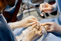 Cứu sống cô gái bị sốc phản vệ nặng sau nâng mũi 