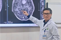 Phẫu thuật nội soi u não qua cung mày, ít xâm lấn