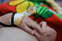 Cao Bằng: Bé 2 tuổi tử vong nghi do mắc sởi