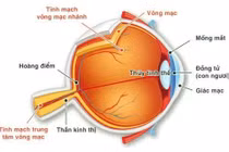 Người phụ nữ suýt mù vì bị tắc tĩnh mạch trung tâm võng mạc