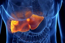 Phát hiện mới hợp chất tự nhiên ức chế tế bào ung thư gan