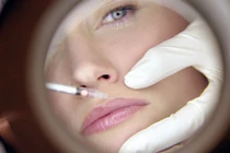 Điểm mặt những loại thẩm mỹ không dao kéo