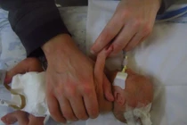 Rúng động về y đức: Y tá tự ý rút máy thở, bé sơ sinh tử vong