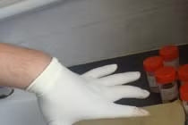 TP.HCM: Phẫu thuật thành công cho ca u phổi to như quả bưởi