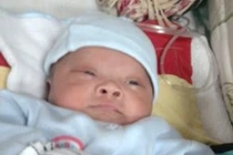 Cứu sống trẻ sơ sinh mắc bệnh phổi hiếm gặp