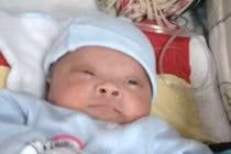 Cứu sống trẻ sơ sinh mắc bệnh phổi hiếm gặp