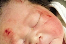 Cảm động mẹ cố sinh con trước khi chết vì tai nạn 