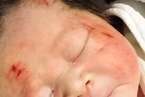 Cảm động mẹ cố sinh con trước khi chết vì tai nạn 