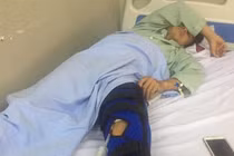 Điều tra vụ “đạn lạc” bay trúng đùi dân ở Hoà Bình