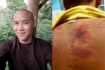 Sự thật phơi bày về thầy chùa bạo hành bé 11 tuổi ở Bình Thuận