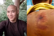 Sự thật phơi bày về thầy chùa bạo hành bé 11 tuổi ở Bình Thuận