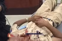 Đại úy CSGT bị người vi phạm dùng đá tấn công bị thương khi làm nhiệm vụ