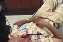 Đại úy CSGT bị người vi phạm dùng đá tấn công bị thương khi làm nhiệm vụ