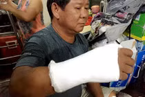 TPHCM: Dân tố bị hành hung khi giải toả dự án Charmington Plaza