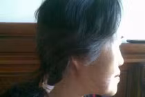 Một phụ nữ bị chó cắn nát mặt, rách chân