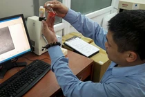 Chuyện chưa kể phía sau ca hiến giác mạc của bé 7 tuổi ở HN