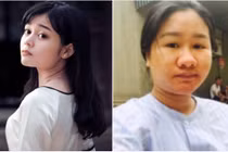 Tâm sự của hot girl xinh đẹp bỗng "xấu tột độ" vì mang bầu 