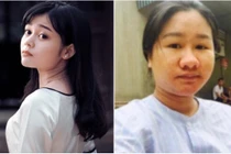 Tâm sự của hot girl xinh đẹp bỗng "xấu tột độ" vì mang bầu 