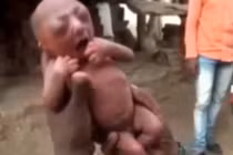 Bé sơ sinh bị bỏ rơi vì hình dạng giống cụ già