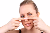 Mẹo trị mụn đầu trắng sạch bong mà không quá tốn kém