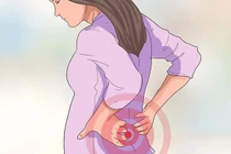 Mắc chứng đau lưng eo phụ nữ cần cảnh giác bệnh nguy hiểm