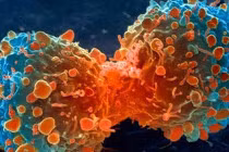 Đột phá trong chữa bệnh ung thư