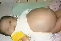 Nhiều bí ẩn chưa biết về hiện tượng trẻ sơ sinh mang thai