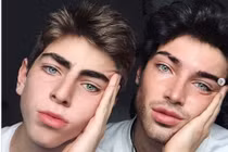 Biến khiếm khuyết cá nhân thành vẻ đẹp mê hoặc