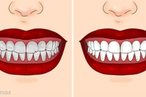 Cơ thể thay đổi kỳ diệu chỉ sau một tuần ăn cần tây