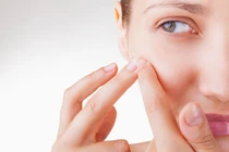 Những thực phẩm càng ăn mụn trứng cá càng mọc đầy mặt