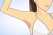 Mẹo trị thâm nách hiệu quả chỉ trong 7 ngày