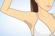 Mẹo trị thâm nách hiệu quả chỉ trong 7 ngày