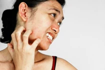 Điều tồi tệ gì xảy ra khi bạn không tắm vài ngày