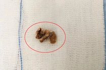 Bé gái nhét dị vật trong “vùng kín”: Dạy trẻ tránh tái phạm