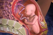 Cảnh báo nguyên nhân và dấu hiệu dẫn đến suy thai mẹ bầu cần thận trọng