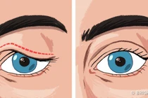 Cẩn trọng với những thay đổi bất thường cảnh báo bạn đang mắc bệnh