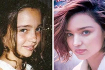 Ngắm ảnh thời thơ ấu của người đẹp nổi tiếng dao kéo