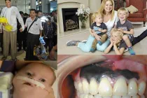 Những chứng bệnh ung thư kỳ quặc